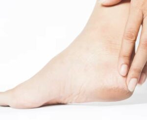 Help Prevent Foot Issues
